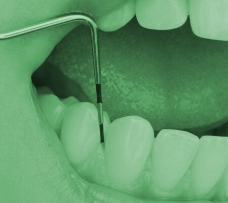 Θεραπευτική οδοντιατρική
