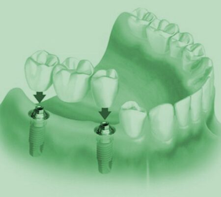 Ορθοπεδική οδοντιατρική