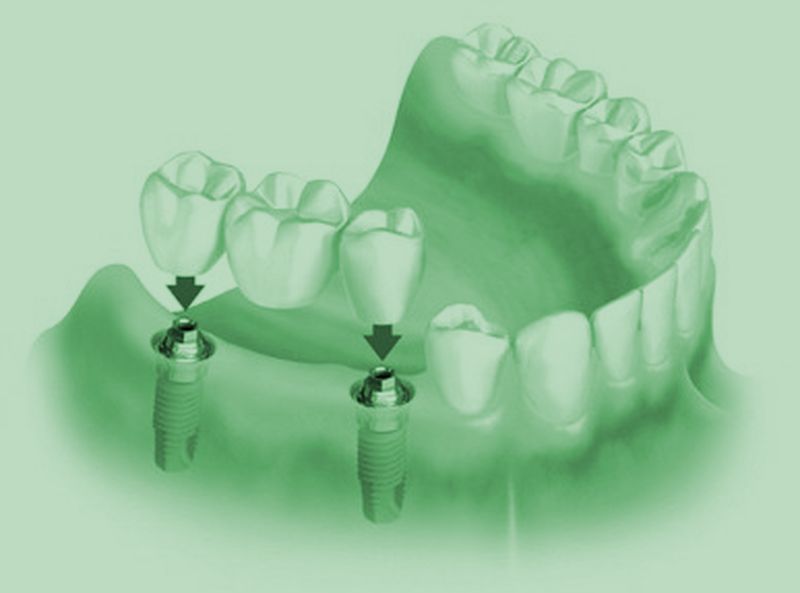 Ορθοπεδική οδοντιατρική